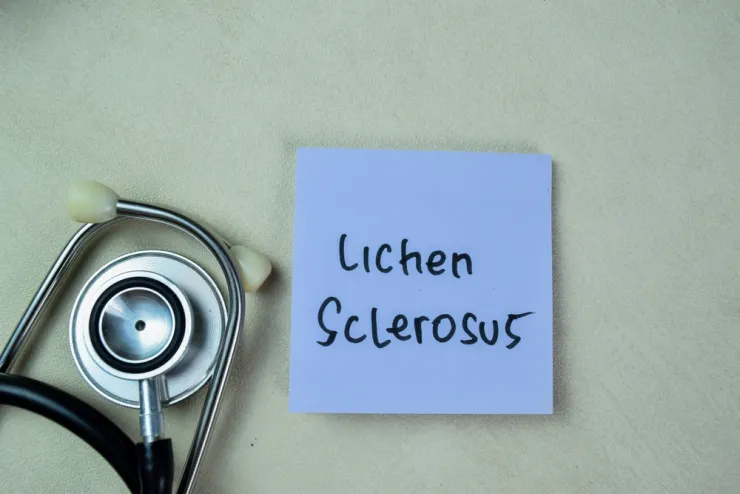 Lichen Sclerosus en Seks, oplossingen en hulpmiddelen