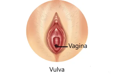 Verschil tussen vagina en vulva